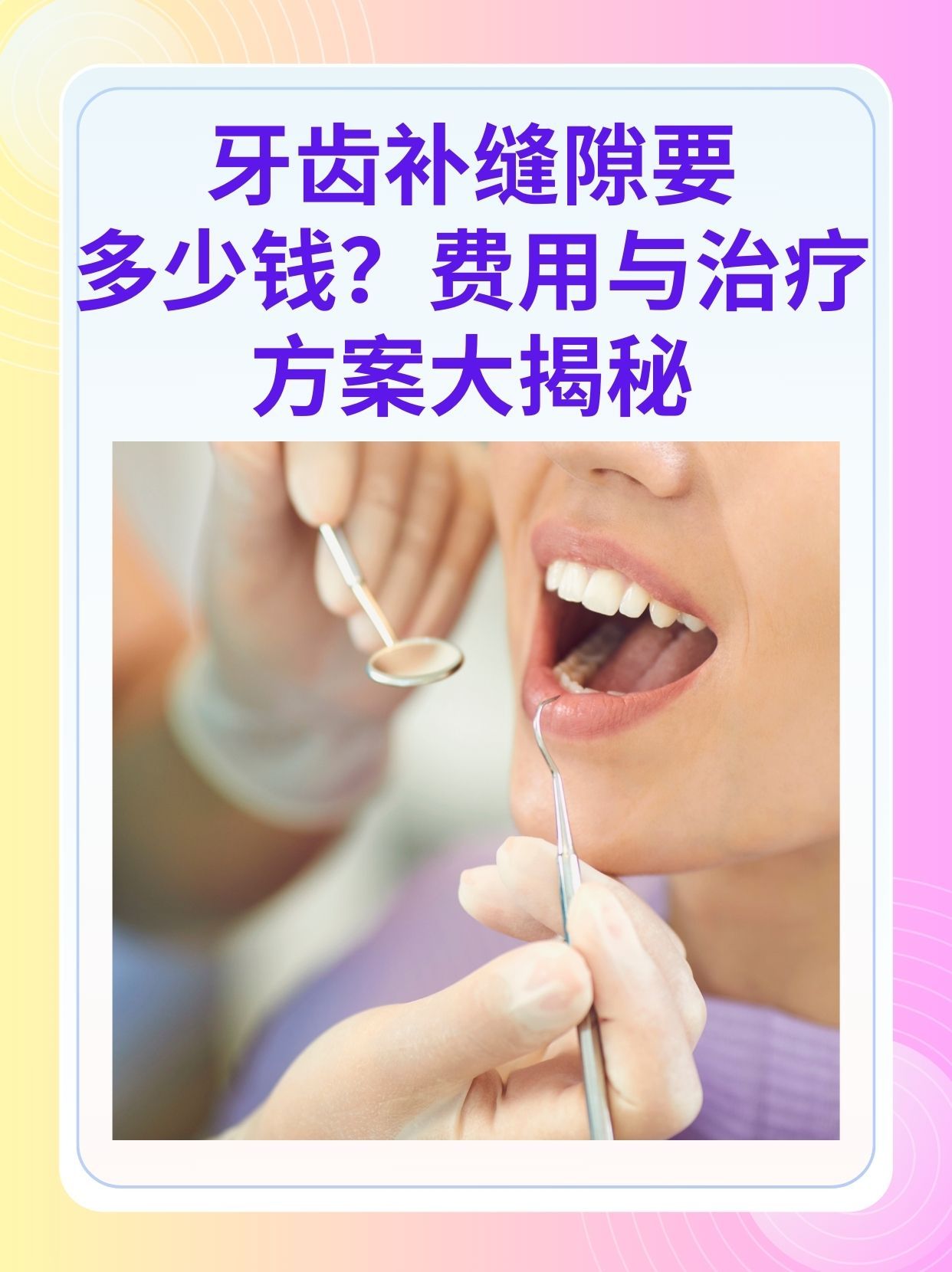 补牙医保可以报销吗(补牙医保可以报销吗 哪些可以报销呢) 补牙医保可以报销吗(补牙医保可以报销吗 哪些可以报销呢)